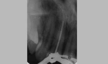 Dental hospital in Anand                        